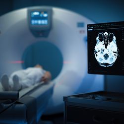 A photo showing a woman entering an MRI machine. She is laying out on a platform while wearing a hospital gown and he head is position just in front of the space for the scanner. This part of the photo is blurred. In the foreground, a screen shows a scan of a portion of her brain. 