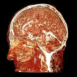 Microvasculature of human head and brain by Scott Echols