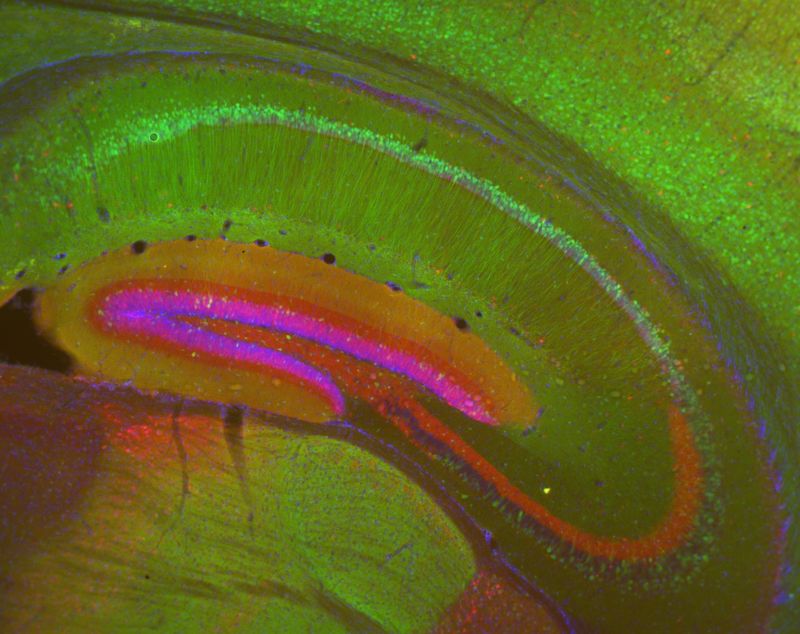 Hippocampus from an Nr4a1-eGFP (green) transgenic mouse stained for calbindin (red) and DAPI to show nuclei (blue). Epifluorescence. Categories: Research in NIH Labs and Clinics Type: Color, Photo Source: National Institutes of Health (NIH)