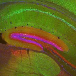 Hippocampus from an Nr4a1-eGFP (green) transgenic mouse stained for calbindin (red) and DAPI to show nuclei (blue). Epifluorescence. Categories: Research in NIH Labs and Clinics Type: Color, Photo Source: National Institutes of Health (NIH)