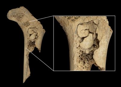 Bone of human child eaten by cannibals