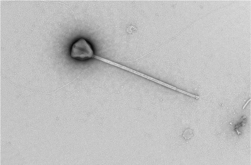 micrograph of virus with long tail