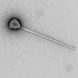 micrograph of virus with long tail