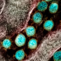 scanning electron micrograph of SARS-CoV-2, shown as blue blobs