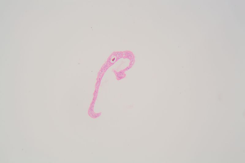 Schistosoma mansoni parasitic worm