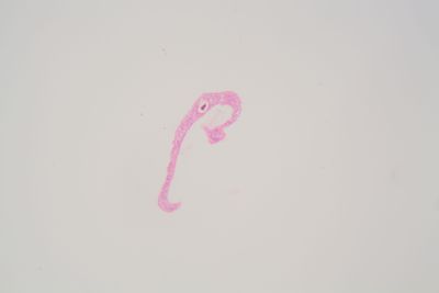 Schistosoma mansoni parasitic worm