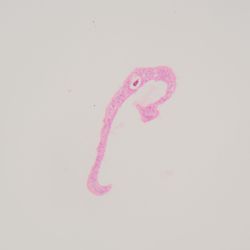 Schistosoma mansoni parasitic worm