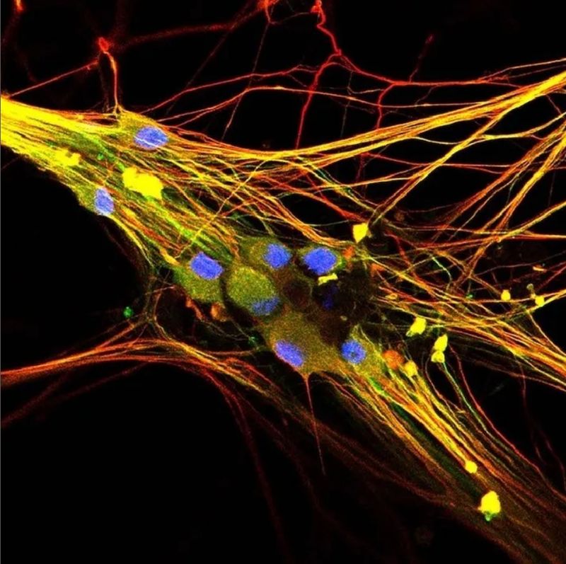 colourful microscope image of sensory neurons; yellow and red strands across a black background with blue orbs on top