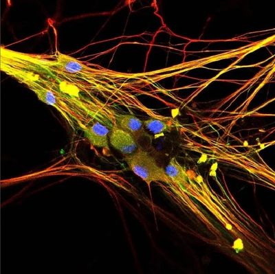 colourful microscope image of sensory neurons; yellow and red strands across a black background with blue orbs on top