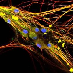 colourful microscope image of sensory neurons; yellow and red strands across a black background with blue orbs on top