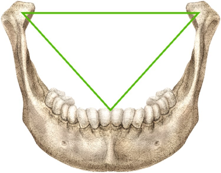Boswell's triangle: a green equilateral triangle inscribed within the lower jaw of a human. Boswell's triangle: a green equilateral triangle inscribed within the lower jaw of a human.