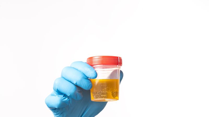 A person is holding a yellow liquid in a plastic container. The container is orange and has a red lid. The person is wearing blue gloves.