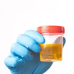 A person is holding a yellow liquid in a plastic container. The container is orange and has a red lid. The person is wearing blue gloves.