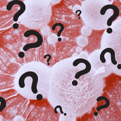 Cancer tumors with metastases with question marks on it.